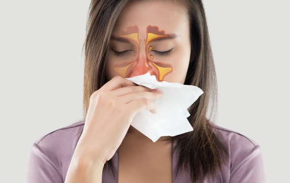 جراحی پولیپ بینی چجوریه؟! | دکتر سمیرا حسینی متخصص گوش حلق بینی